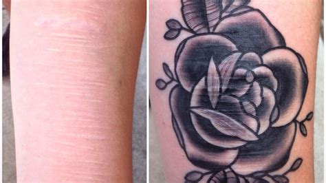 A Tattoo Artist S 10 Years Of Turning Scars Into Art Npr A Tattoo Artist S 10 Years Of Turning Scars Into Art Npr