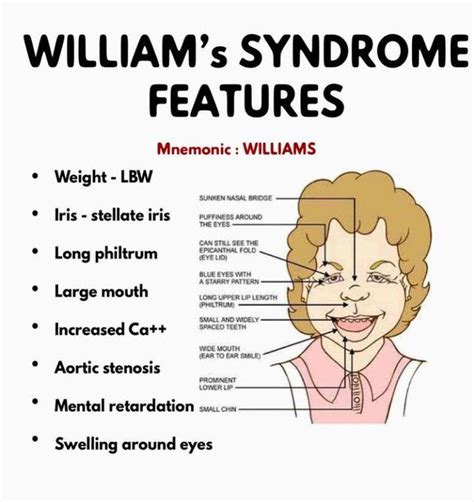 About Williams Syndrome