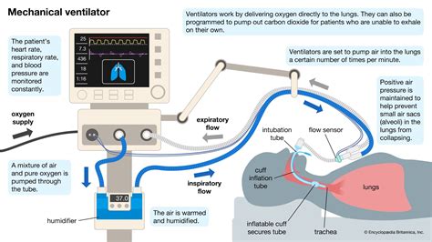 Basics In Mechanical Ventilation Getting To Know Its Parameters And Set Up Description From Basics In Mechanical Ventilation Getting To Know Its Parameters And Set Up Description From