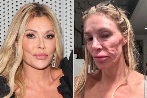 Brandi Glanville Sells Off Her Rhobh Wardrobe Amp Joins Onlyfans Again Amid Health Crisis Brandi Glanville Sells Off Her Rhobh Wardrobe Amp Joins Onlyfans Again Amid Health Crisis