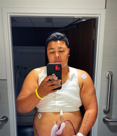 Comprehensive Guide Scar Care After Top Surgery Motivo Scar Care