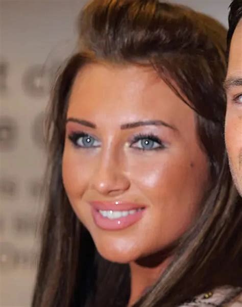 Din Ii Lui Lauren Goodger Vechi Noi Nainte I Dup Lema Dental Clinic