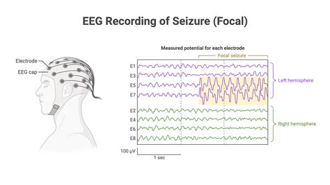 EEG and Brain Function Explained