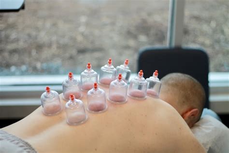 Find Out How To Ease Muscle Discomfort With Gliding Cupping Lorraine S Treatment Room