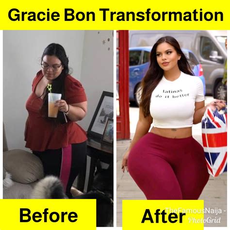 Gracie Bon Biography Wikipedia Age Pictures Husband Surgery Before Amp After