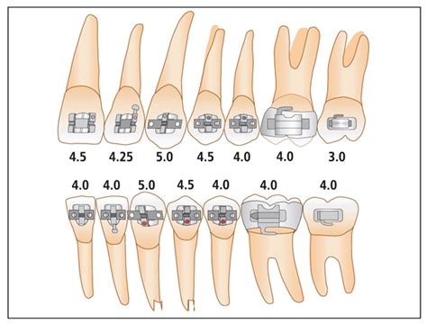 How To Place The Orthodontic Bracket On The Teeth Correct Orthodontic Bracket Positions
