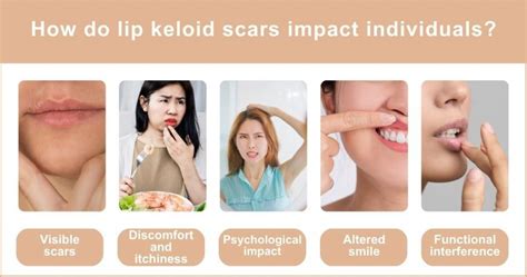 Keloid Scar Lip Treatment Options Regain Your Smile Keloid Scar Lip Treatment Options Regain Your Smile