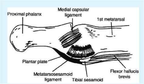 Medial View Of The Hallux Metatarsophalangeal Joint Courtesy Of Download Scientific Diagram Medial View Of The Hallux Metatarsophalangeal Joint Courtesy Of Download Scientific Diagram