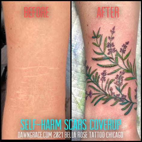 Melville Artist Offers Free Tattoos To Cover Scars From Self Harm Cbc News Melville Artist Offers Free Tattoos To Cover Scars From Self Harm Cbc News