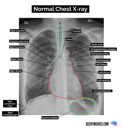 Normal X Ray