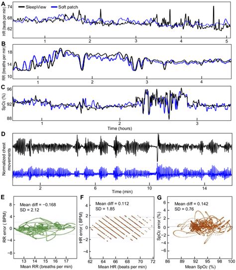 Overnight Sleep Study With Patients And Healthy Control Subjects A Download Scientific Diagram Overnight Sleep Study With Patients And Healthy Control Subjects A Download Scientific Diagram
