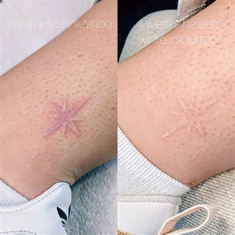 Pin By Mafalda Amaro On Tattoo White Ink Tattoos Healed White Ink Tattoo White Tattoo