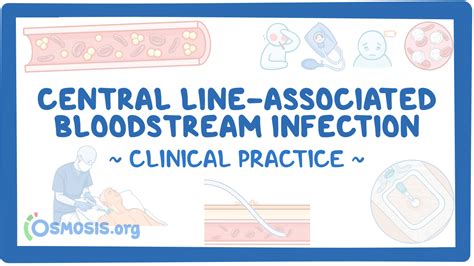 Practices To Prevent Central Line Associated Bloodstream Infection A 2021 Survey Of Infection Preventionists In Us Hospitals Infection Control Hospital Epidemiology Cambridge Core