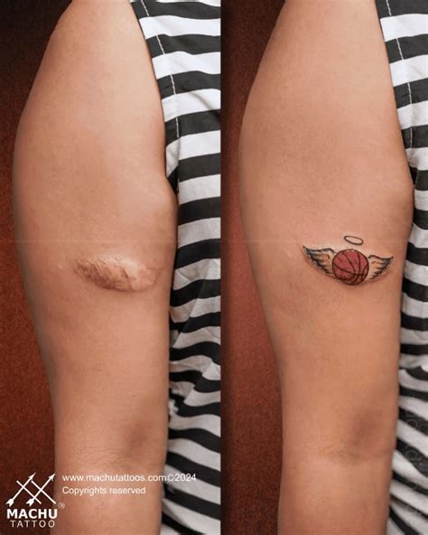 Scar Mark Cover Up Tattoo Design Machu Tattoo Studio