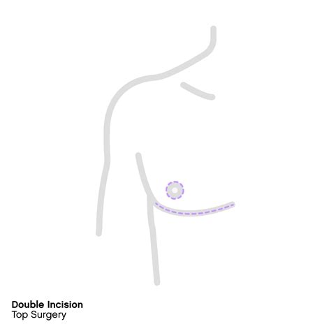 Top Surgery 101 Procedures Cost And Safety By Folx