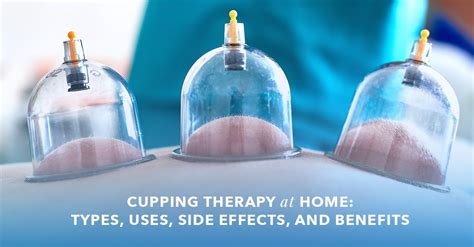 What Is Cupping Therapy Uses Benefits Side Effects And More