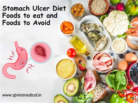 What To Eat And Avoid With A Stomach Ulcer