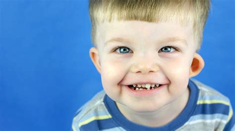 Williams Syndrome Diagnosis Support Raising Children Network